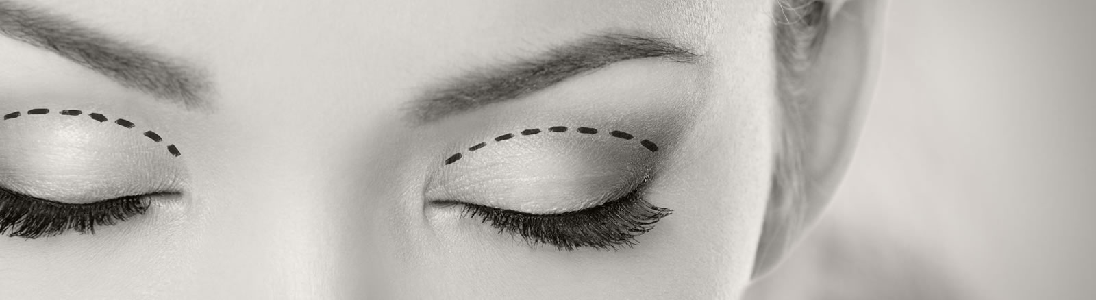 Eyelid Treatments